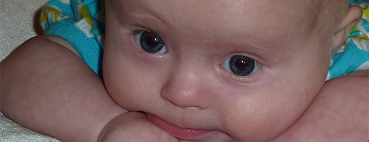 Baby med Downs syndrom