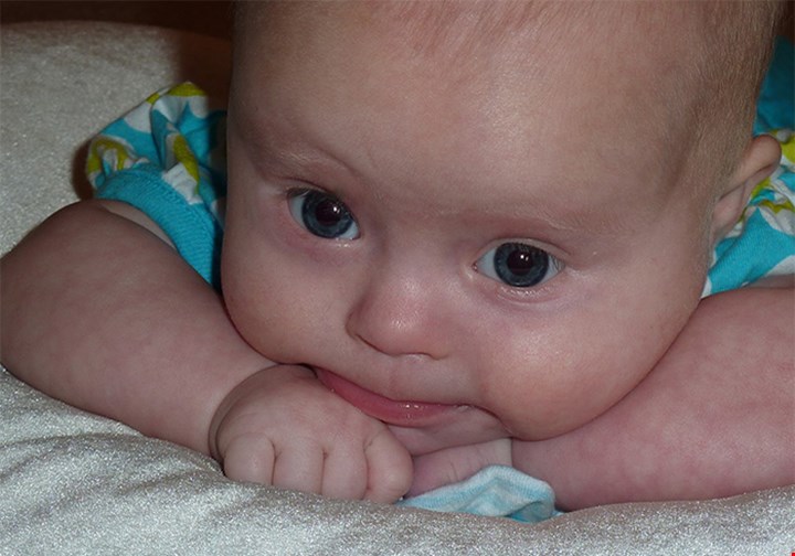 Baby med Downs syndrom