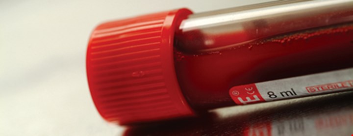 Fotografi av blodprøve