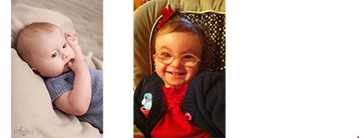 To barn med trisomi 18