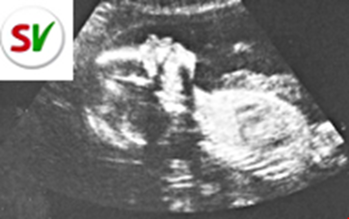 Ultralydbilde med SV logo